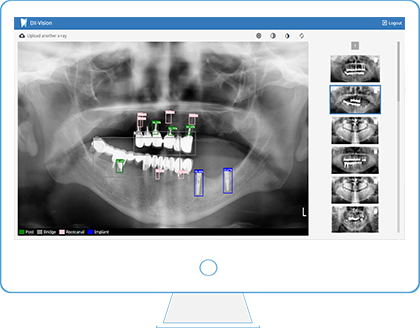 Dx Panel free testing of machine learning algorithm