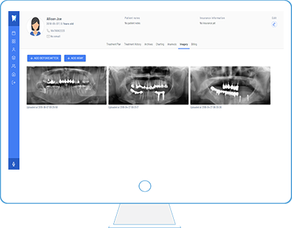 Eletronic Dental Records with X Rays Dentem Web Platform
